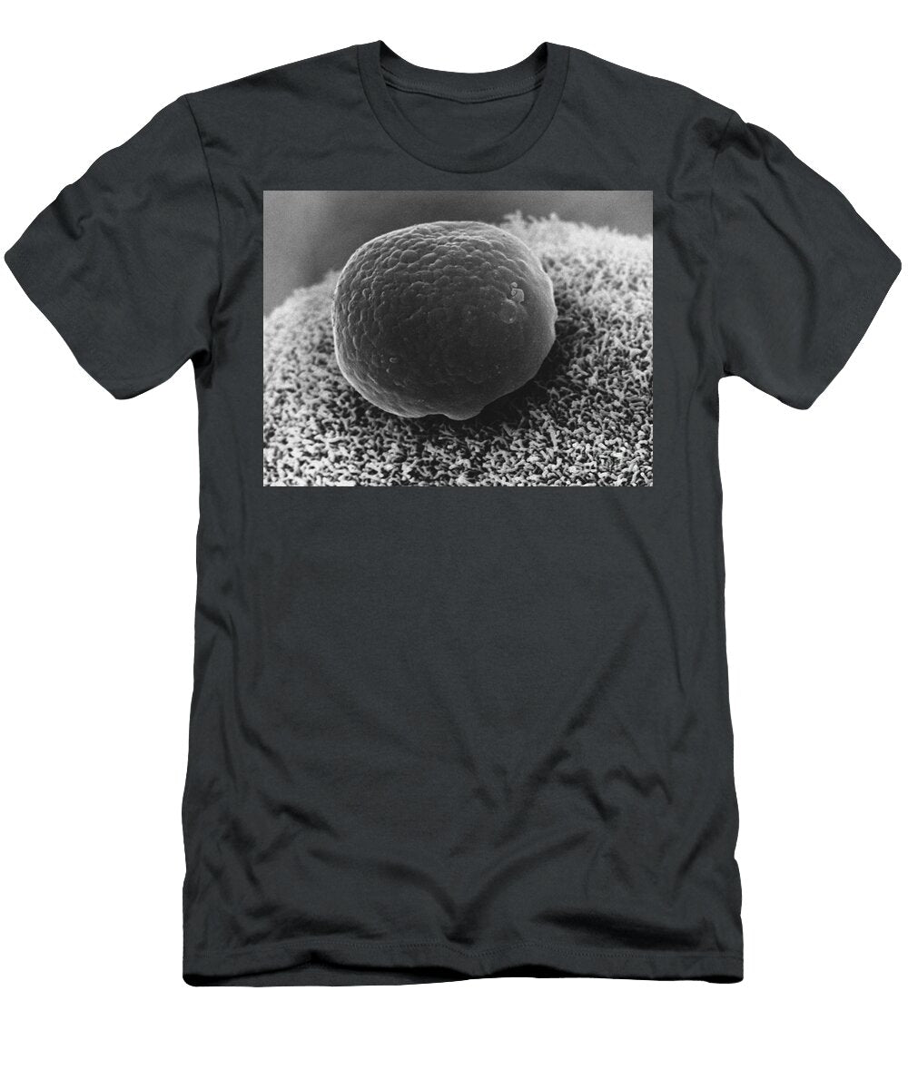 1 Polar Body on Hamster Ovum Sem David M Phillips T-Shirt