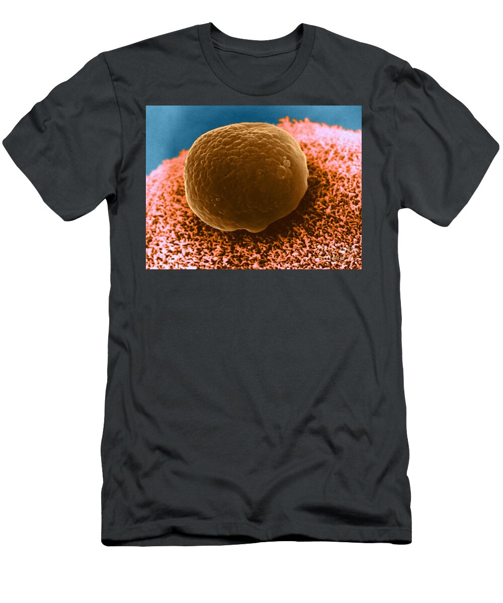 1 Polar Body on Ovum Sem David M Phillips T-Shirt