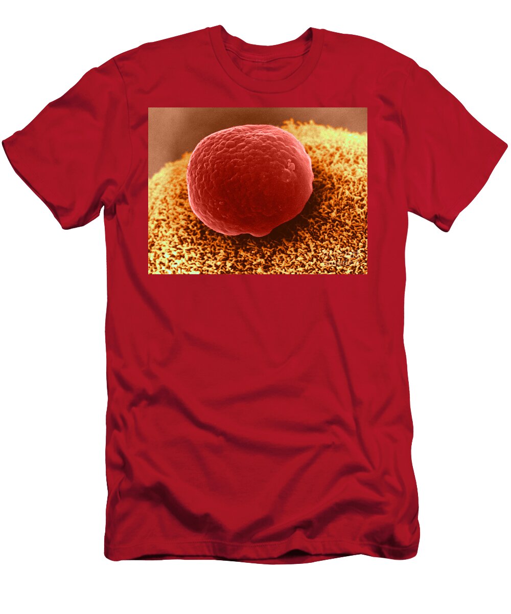 3 Polar Body on Ovum Sem David M Phillips T-Shirt