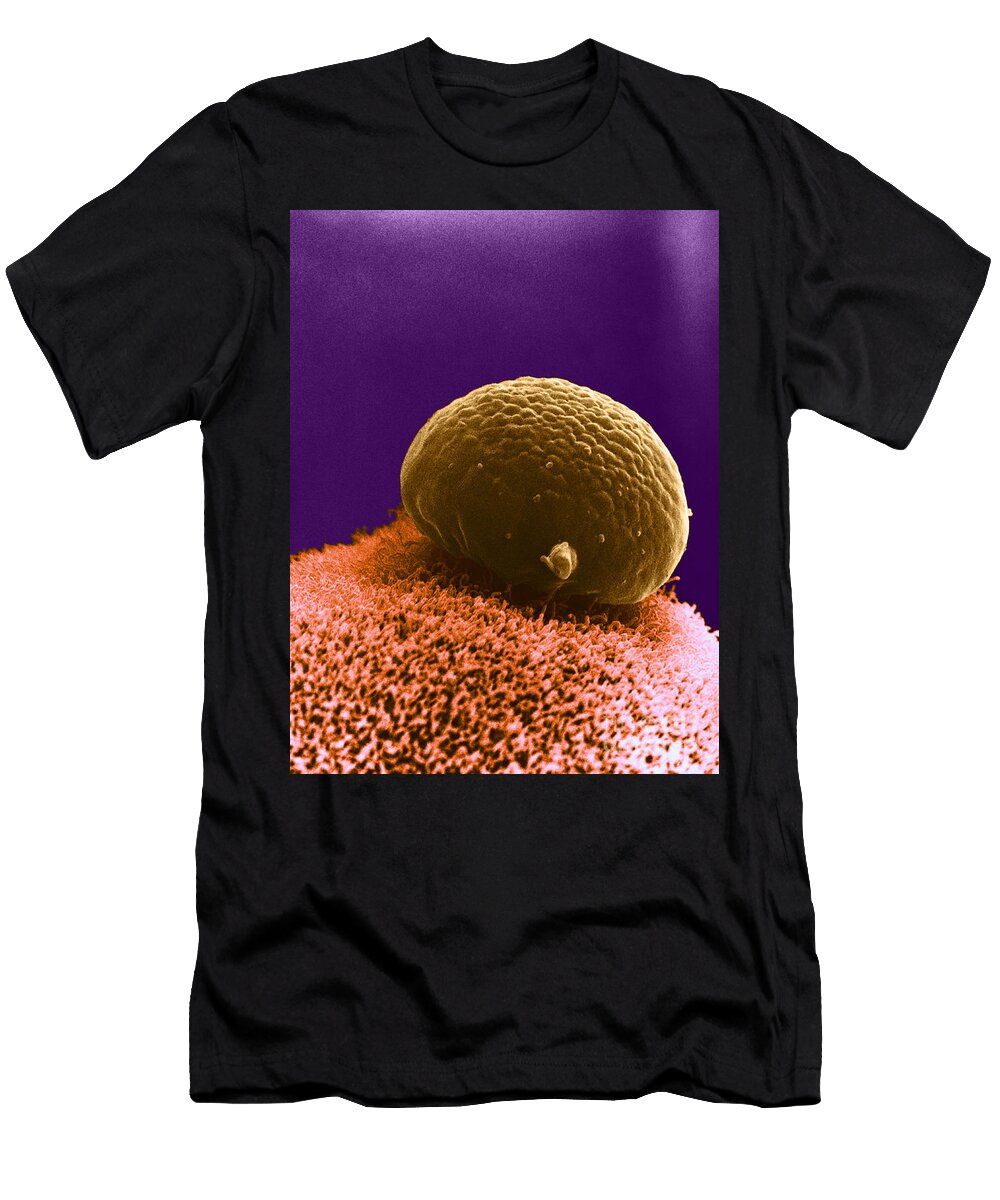 4 Polar Body on Ovum Sem David M Phillips T-Shirt