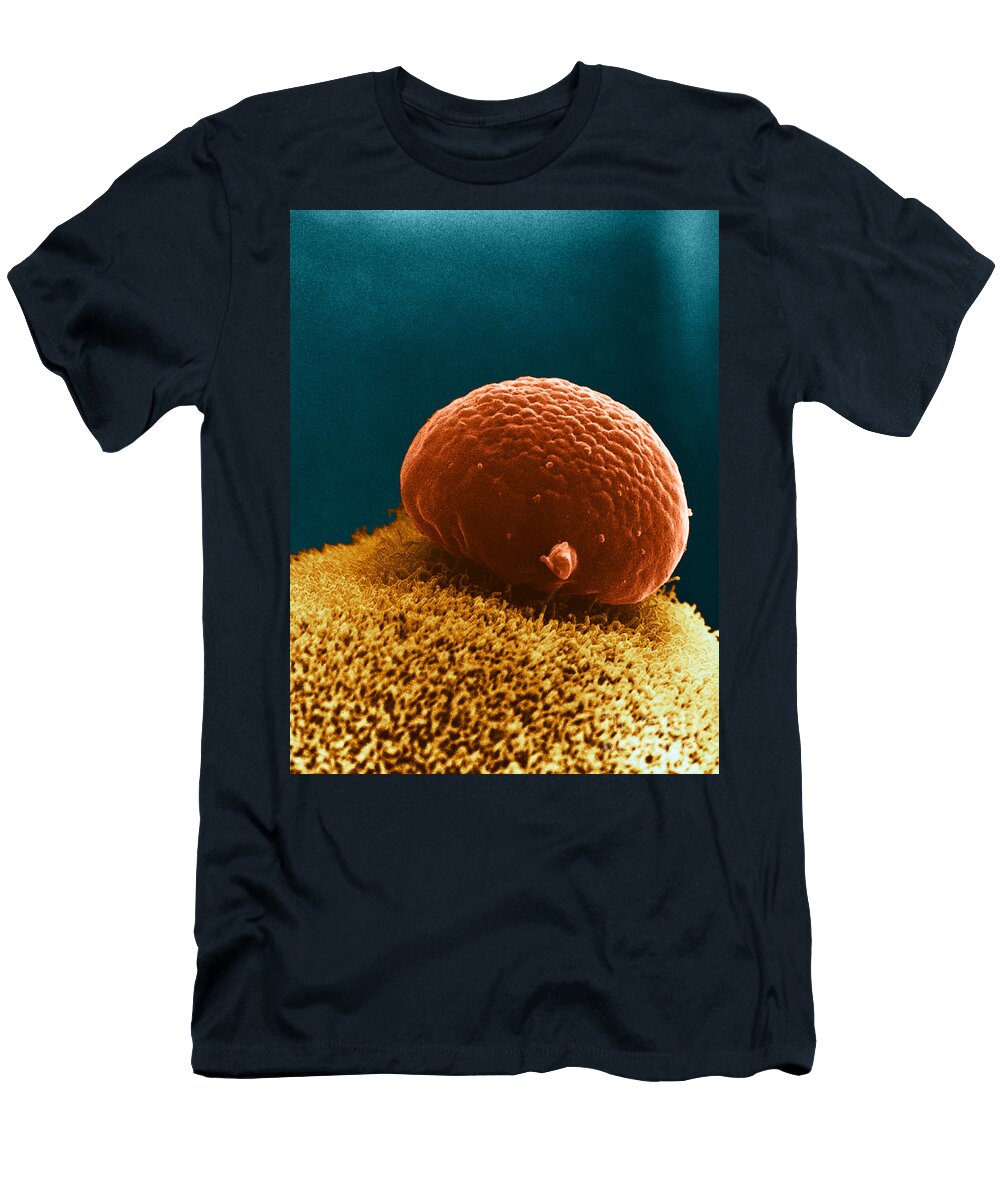 Polar Body on Ovum Sem David M Phillips T-Shirt